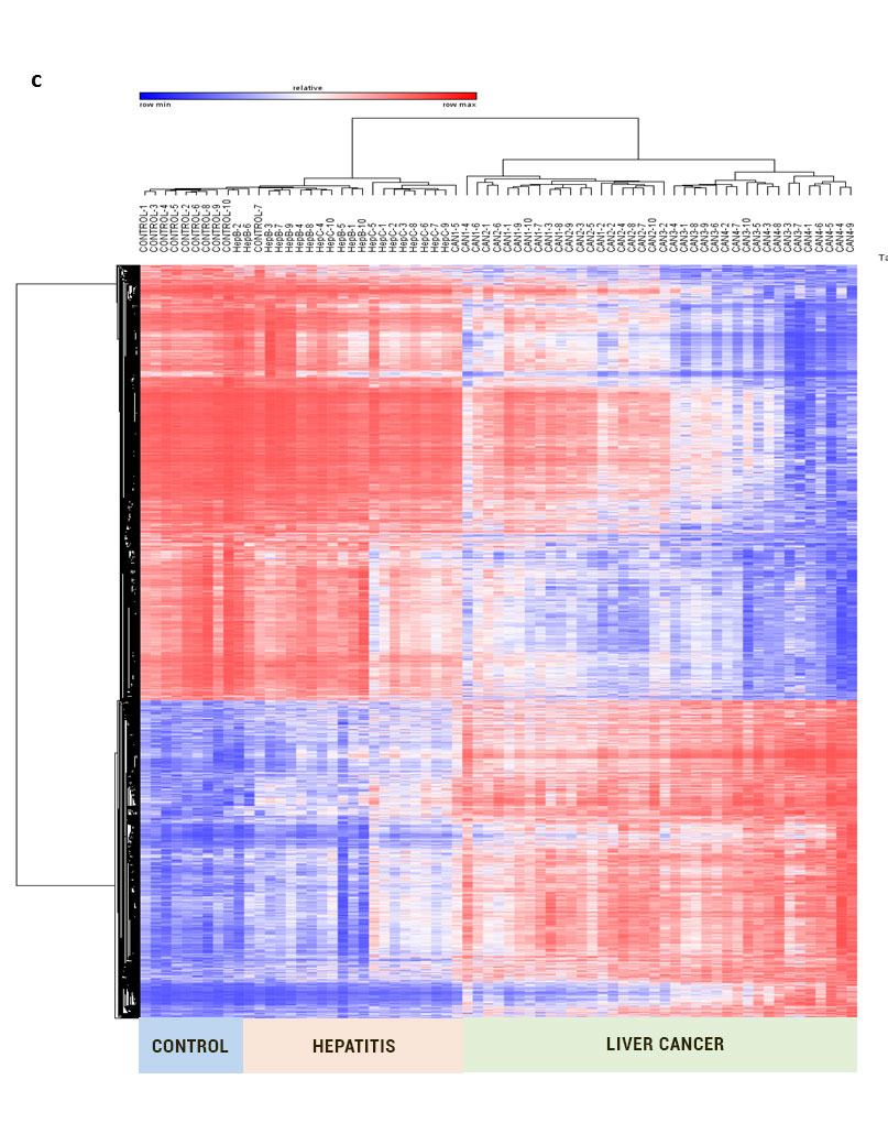 Early detection of cancer by DNA Methylation. Epigen Experts